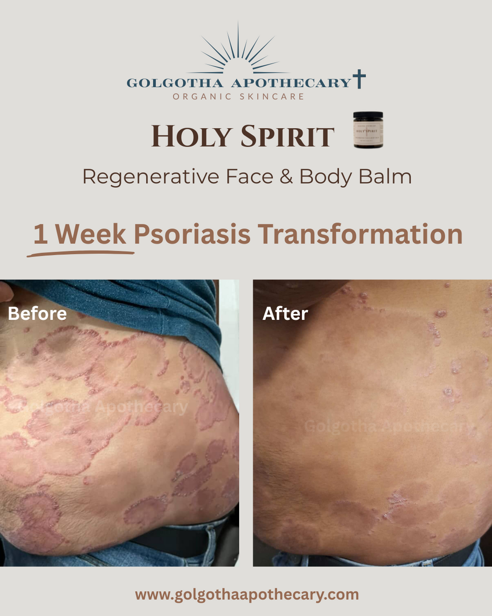Holy Spirit Regenerative Face & Body Balm