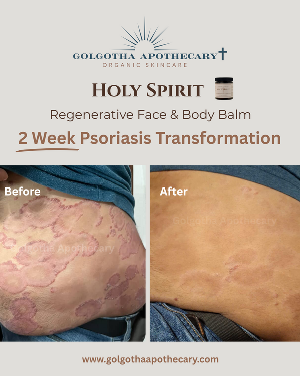 Holy Spirit Regenerative Face & Body Balm