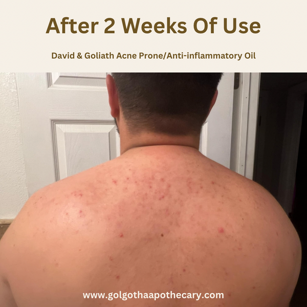 David & Goliath Anti-Inflammatory/Acne Prone Face Oil