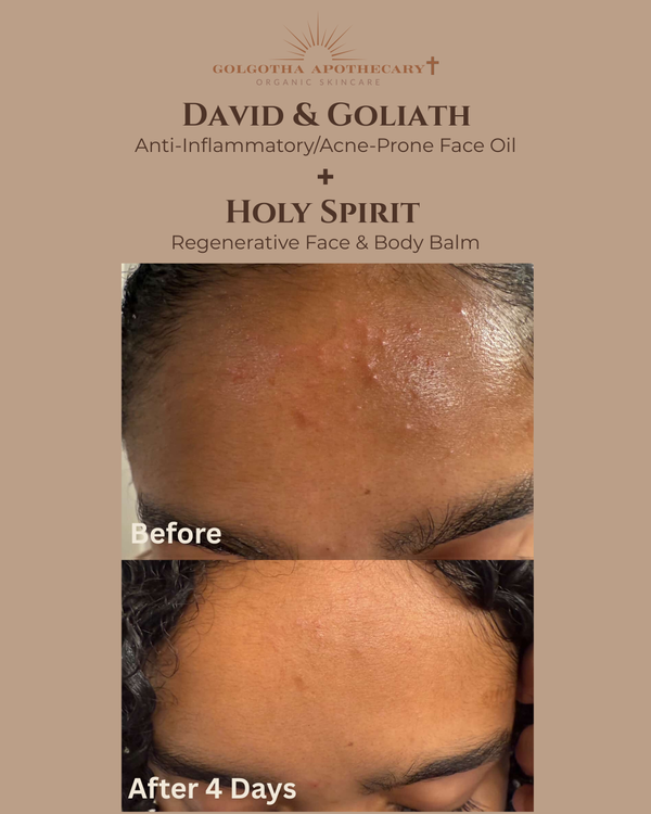 David & Goliath Anti-Inflammatory/Acne Prone Face Oil