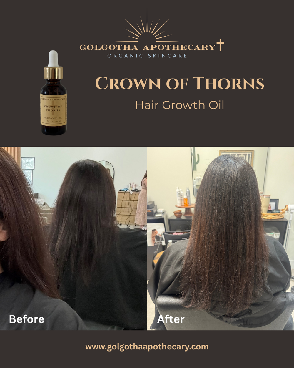 Crown of Thorns Hair Growth Oil